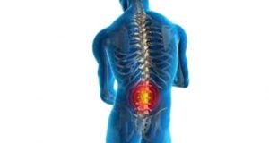 LOMBER DİSKOPATİ (BEL FITIĞI)