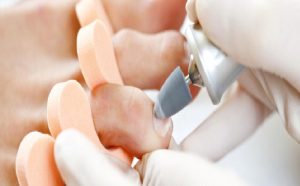 Medikal El ve Ayak Bakımı