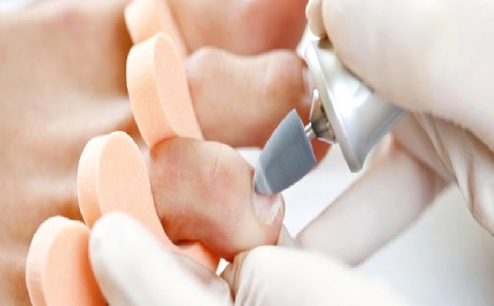 Medikal El ve Ayak Bakımı