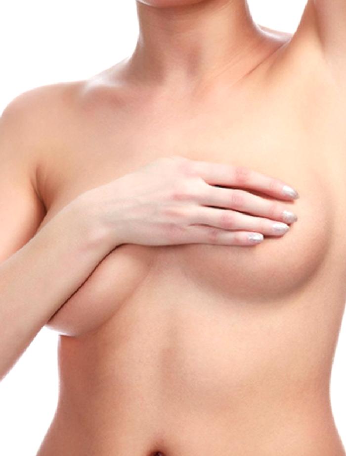 MEME DİKLEŞTİRME (GÖĞÜS DİKLEŞTİRME)