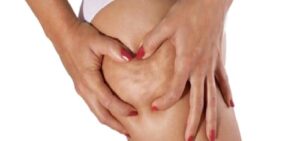 Mezoterapi İle Selülit Tedavisi