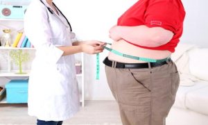 Mide Küçültme Ameliyatı Hangi Bölüm Hangi Branş ?