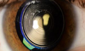 MULTİFOKAL MERCEKLER