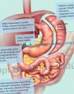 Obezite Cerrahisi Sonrası Genel Kurallar
