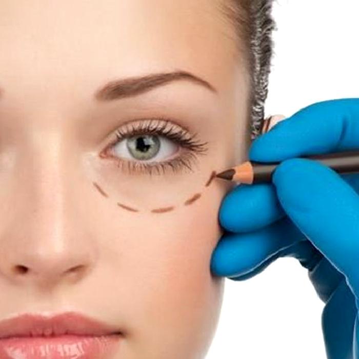 Okuloplasti Nedir?