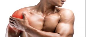 Omuz Yırtıkları Sık Sorulan Sorular