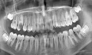 Oral Diagnoz ve Radyoloji