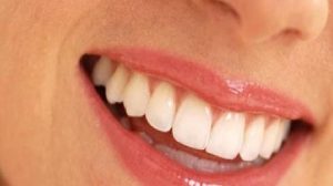 Ortodonti Genel Bilgiler