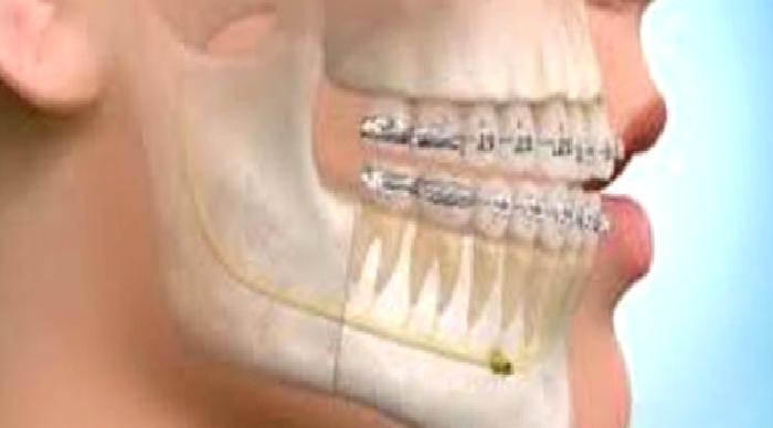 Ortodonti Tedavileri