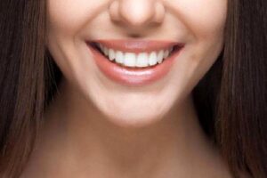 Ortodonti Ve Gülümseme Estetiği