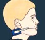 Ortodontide kullanılan apareyler