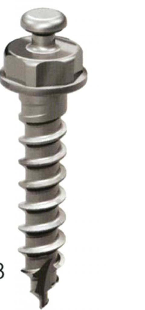 Ortodontide minivida uygulamaları