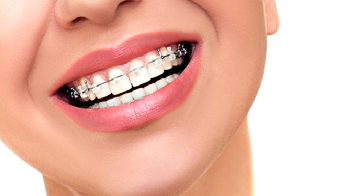 Ortodontik Tedavi ..