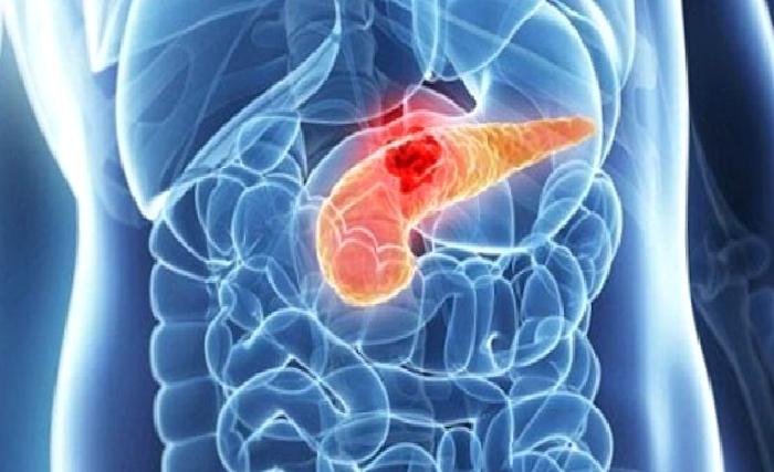 Pankreas Hastalıkları