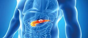 Pankreas Kanseri Nedir?