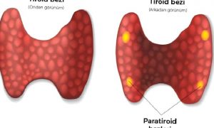 Paratiroid