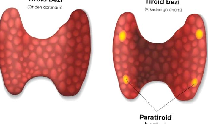 Paratiroid