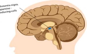 PARKİNSON HASTALIĞI