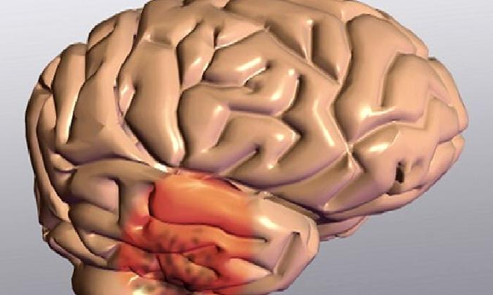 Parkinson Hastalığı Tanısı Nasıl Konur?