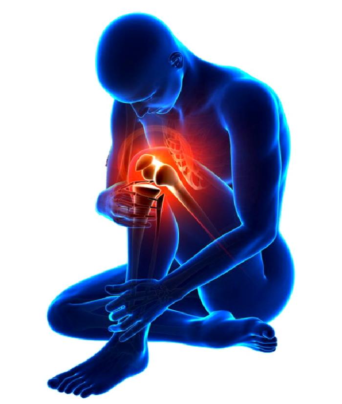 Patella Kırıkları