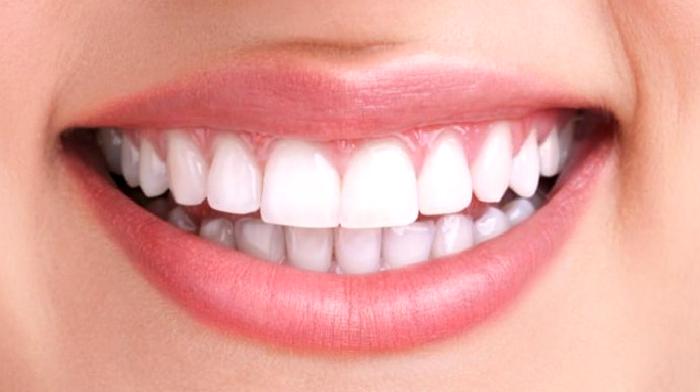 Pembe Estetik Nedir?