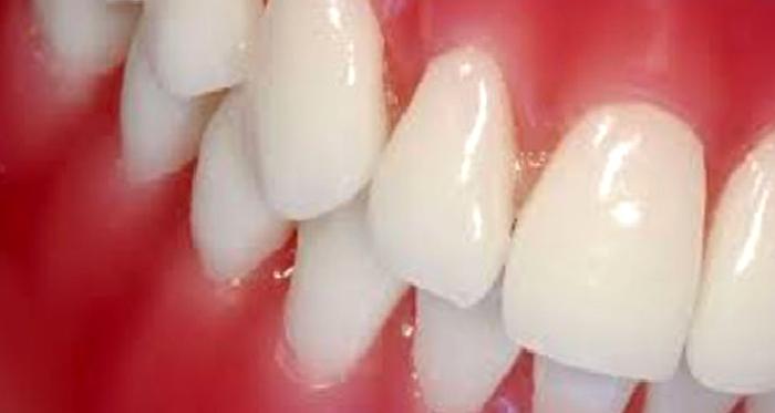 Periodontoloji