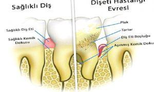 Periodontoloji