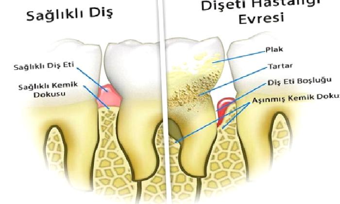 Periodontoloji