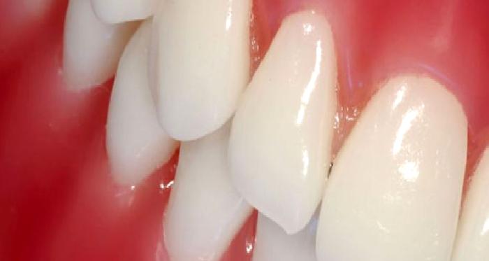Periodontoloji