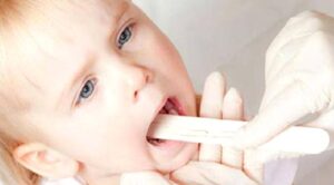 PERİYODİK ATEŞ , AFTÖZ STOMATİT, FARENJİT , SERVİKAL ADENİT SENDROMU (PFAPA SENDROMU )