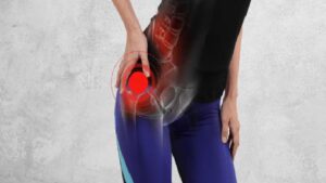 Piriformis Sendromu Nedir?