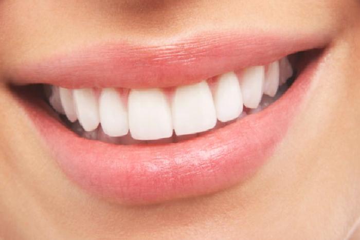 Porselen Dişler (Kaplamalar)