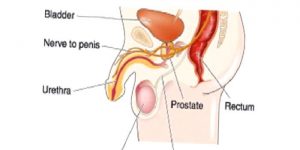 Prostat Hastalıkları