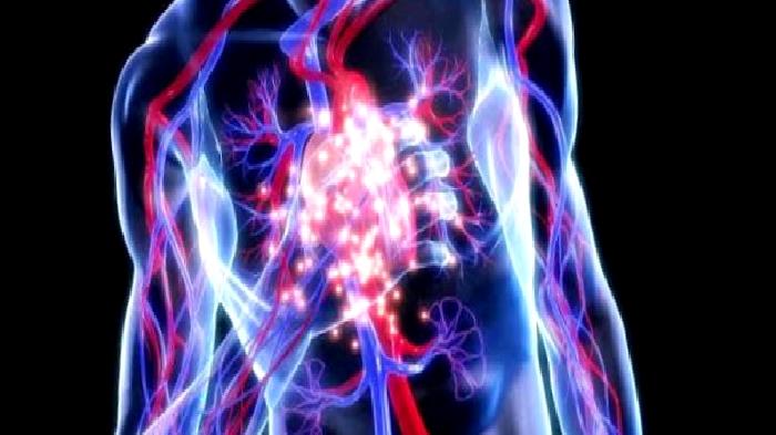 Pulmoner Tromboemboli (Akciğer Embolisi)