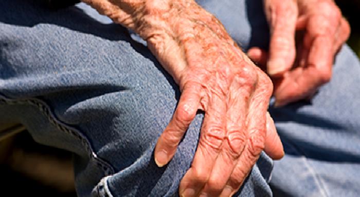 Romatizma Hakkındaki Yaygın, Ancak Yanlış Kanılar