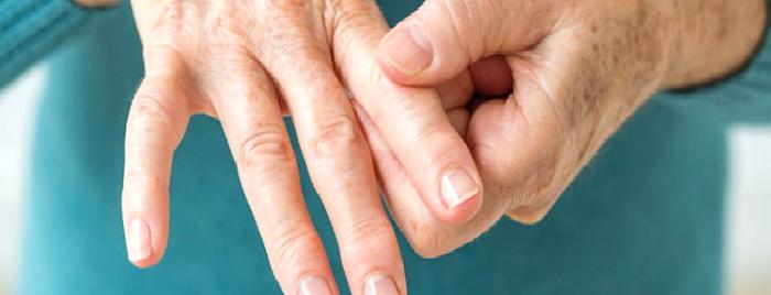 Romatoid Artrit Nedir?