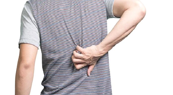 Sacrococcygeal Pilonidal Sinus (Kuyruk sokumunda yerleşmiş kıl dönmesi hastalığı)