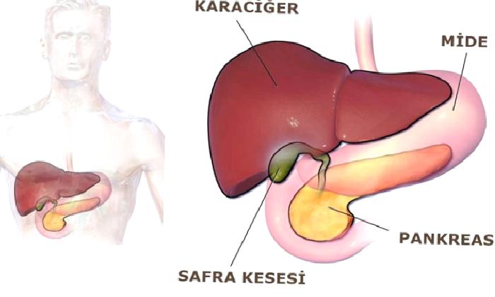 Safra Kesesi Taşı Ameliyatı (Yararları & Zararları)