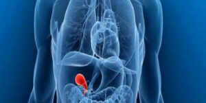 Safra Kesesi Taşlarının Ebadına Göre Tedavi Değişir Mi?