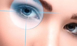 SARI NOKTA HASTALIĞINDA GÖZİÇİ TELESKOPİK LENSLER