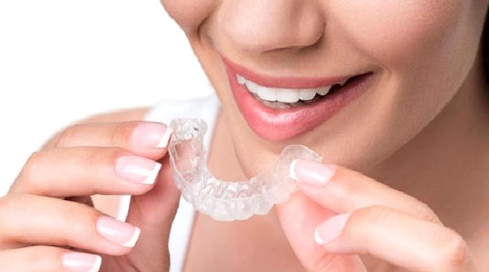 Şeffaf Apareyler İle Ortodontik Tedavi