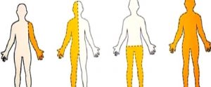 Serebral Palsi