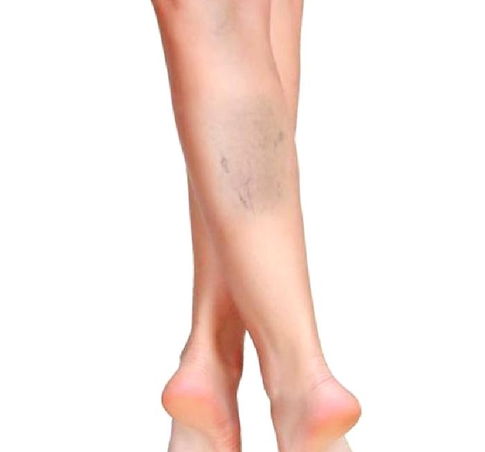 Sıcak Hava ve Varis