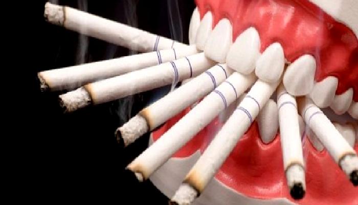 Sigaranın Ağız Sağlığı ve Dişlere de zararı Büyük