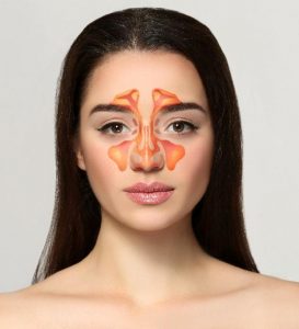 Sinüzit: Ciddi Bir Sağlık Problemidir