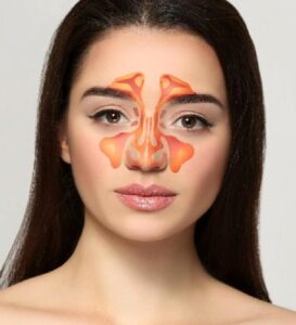 Sinüzit ve Diş Ağrısı Birbirine Karışabilir