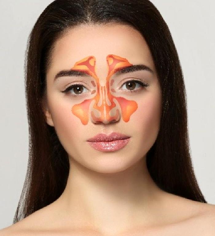 Sinüzit ve Diş Ağrısı Birbirine Karışabilir