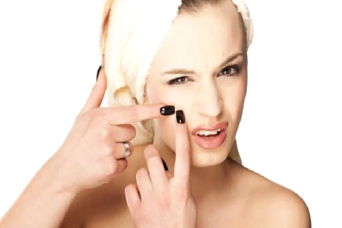 Sivilce İzlerinden Kurtulmanın 7 Yolu