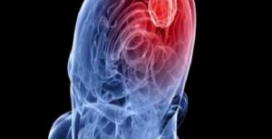 Şok ve Tedavi Yöntemleri