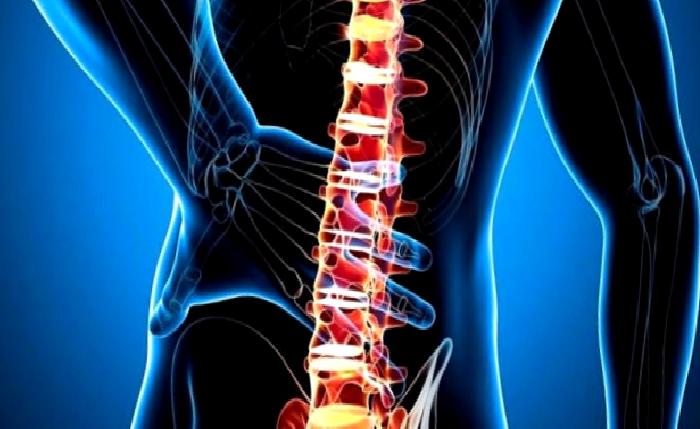 Spinal Cord Stimülasyon Tedavisi